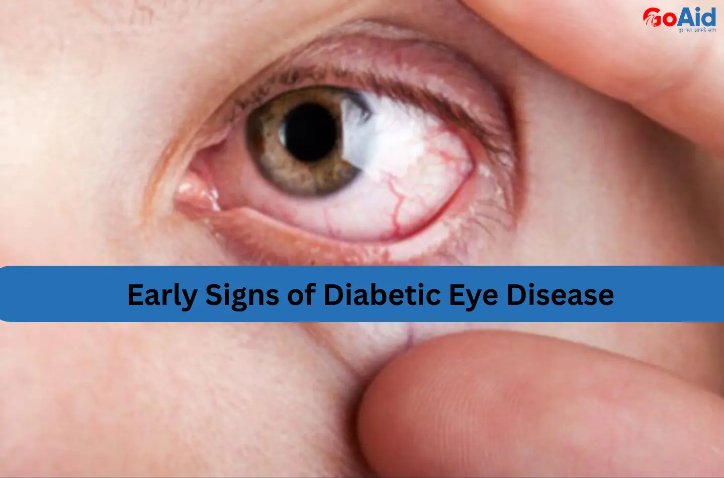 Early Signs of Diabetic Eye Disease